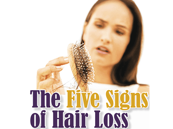 5 Signs of Hair Loss