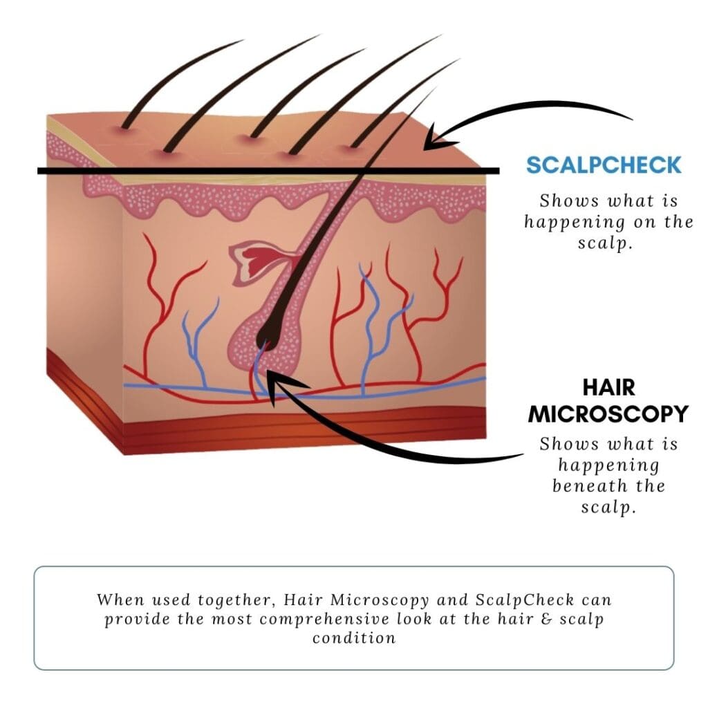 Hair Microscopy Jeffrey Paul's Hair & Scalp Specialists