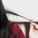 hair loss causes